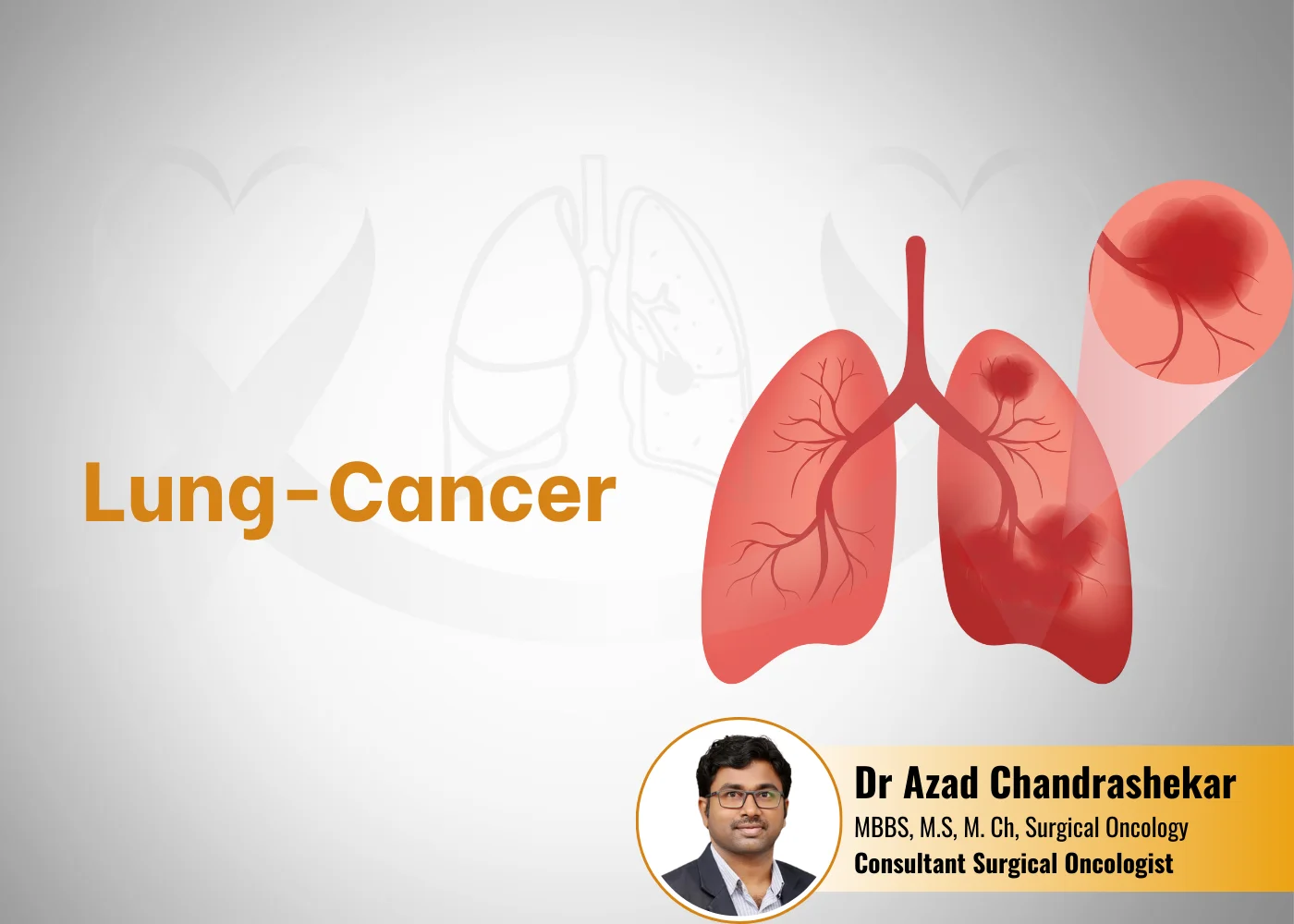 best Lung-Cancer treatment in Hyderabad